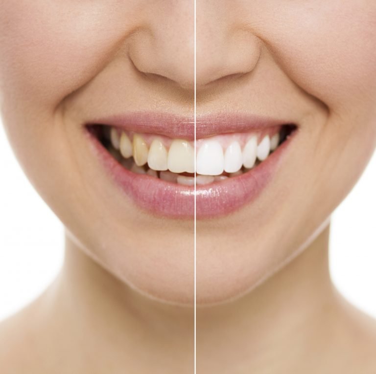 Cosmetic Dentistry Edinburgh Smile Plus Dental Care